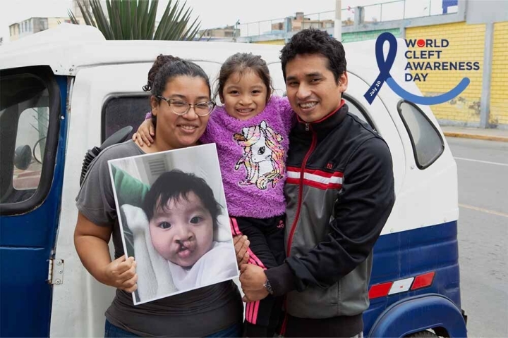 Itzayana smiling and hugging her parents Xiomara and Sandro and holding a picture of herself before cleft surgery, with the World Cleft Awareness Day logo to the right of them