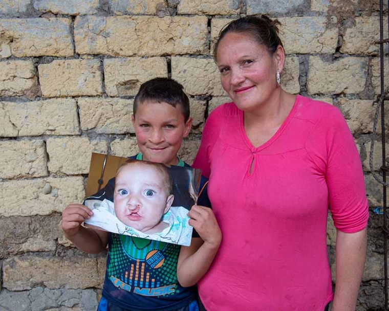 Neitan holding an image of himself before cleft lip surgery with his mom