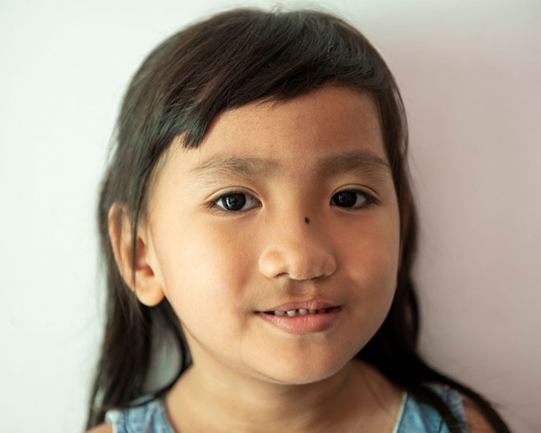 Meng shows off her smile after Smile Train-sponsored cleft treatment.