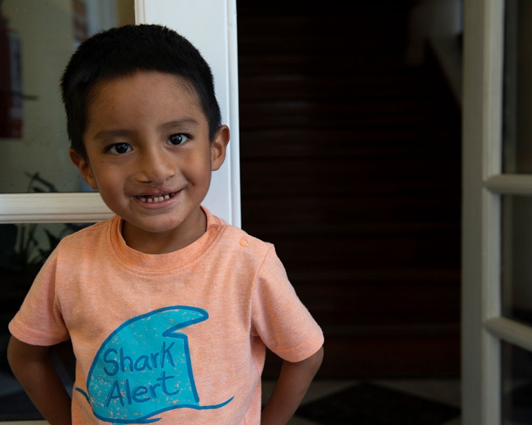Anghelo smiles after receiving free local cleft lip and palate surgery in Peru.