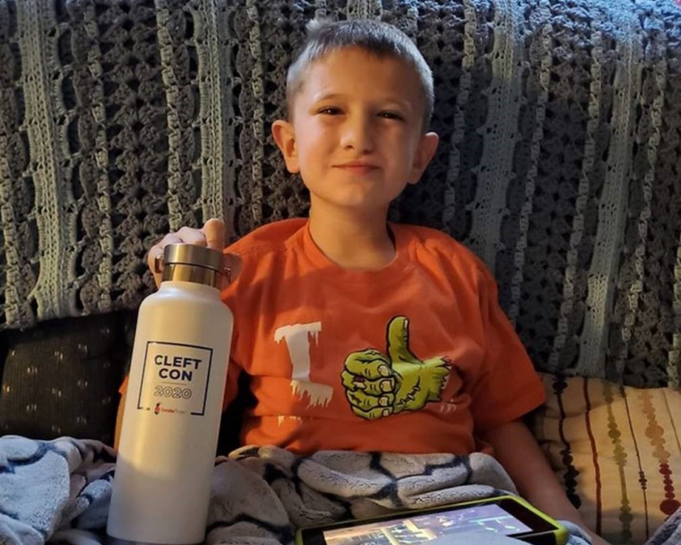 boy with cleft con bottle