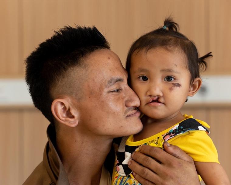 La Vang holding Nalee before her cleft surgery