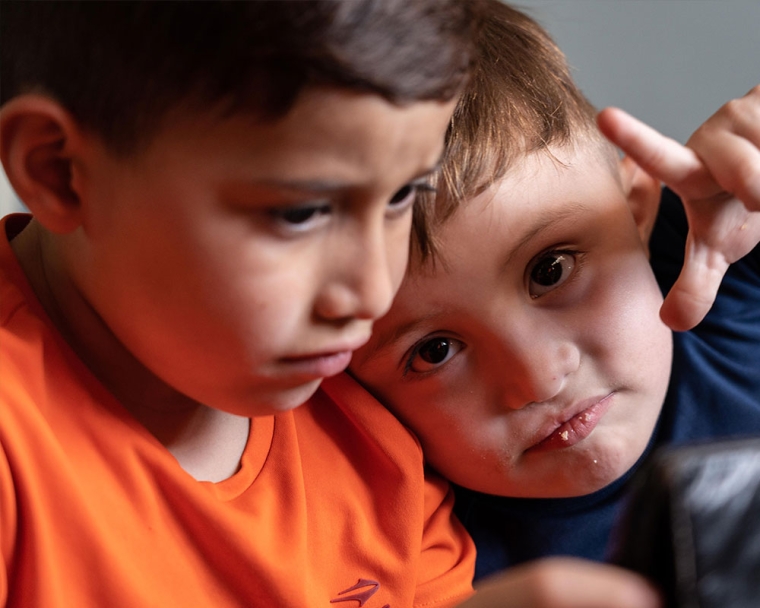 Edden hugging his brother after cleft surgery