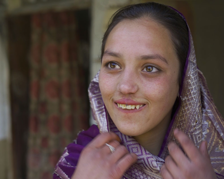 Sheema smiling after cleft surgery