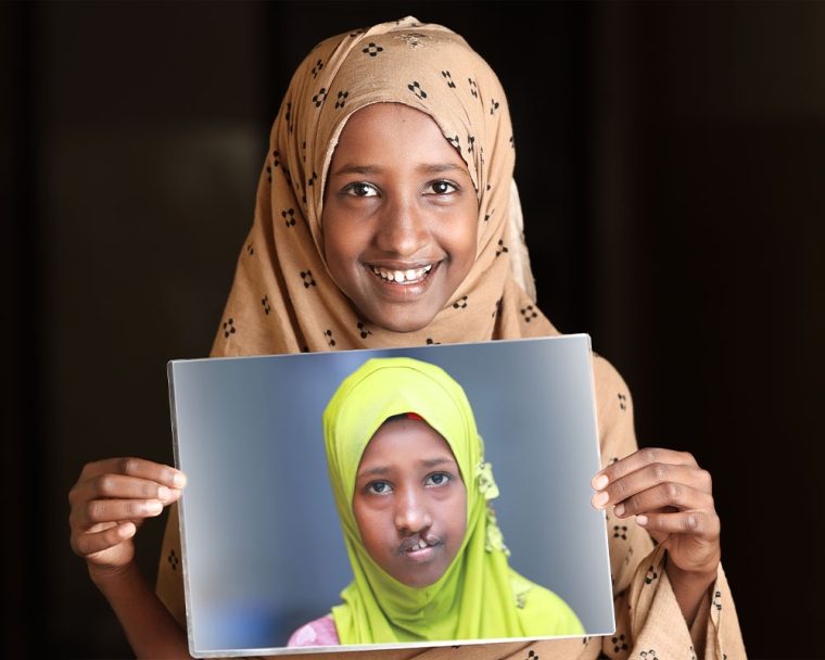 Maryan smiling and holding a photo of herself before cleft surgery