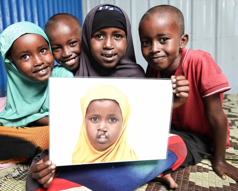 Nasro smiling and holding a photo of herself before cleft surgery