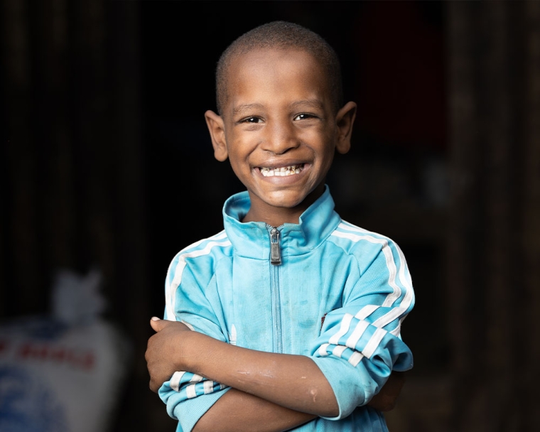 Omar smiling after cleft surgery