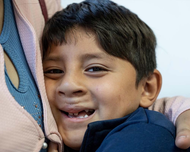 Ezequiel smiling after cleft surgery