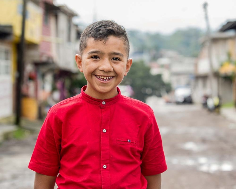 Jesus smiling after cleft surgery