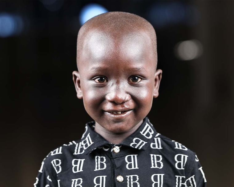 Jacob smiling after cleft surgery