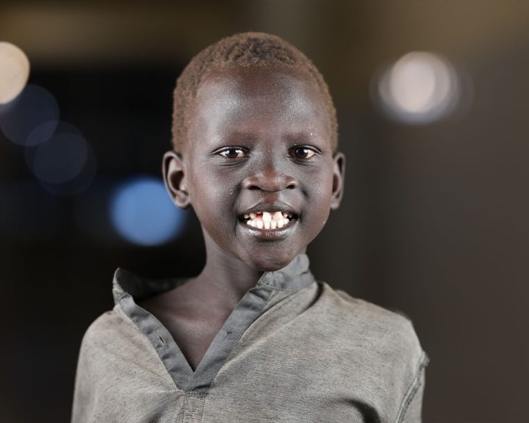 Machiek Makur smiling after cleft surgery
