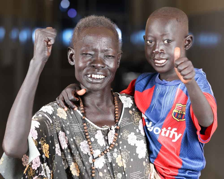 Ngor smiling and giving a thumbs up with his mother Abuk after cleft surgery