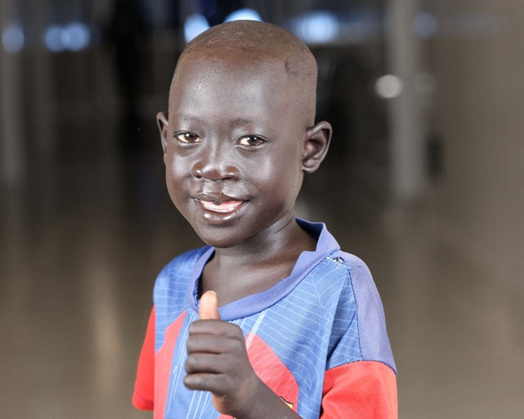 Ngor smiling and giving a thumbs up after cleft surgery