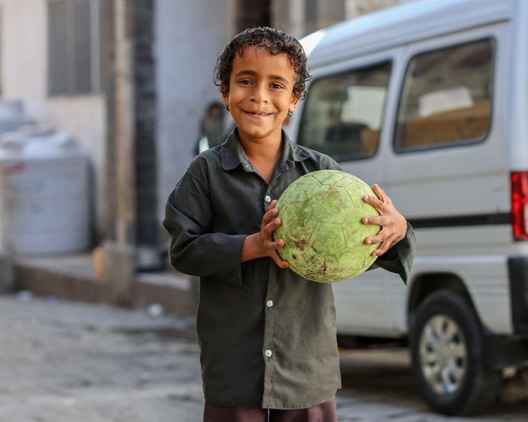 Bilal smiling and holding a soccer ball after cleft surgery