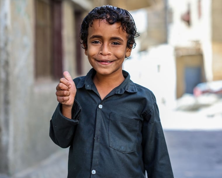 Bilal smiling and giving a thumbs up after cleft surgery