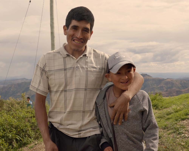 Diego smiling with his father Zacarias's arm around him after cleft surgery