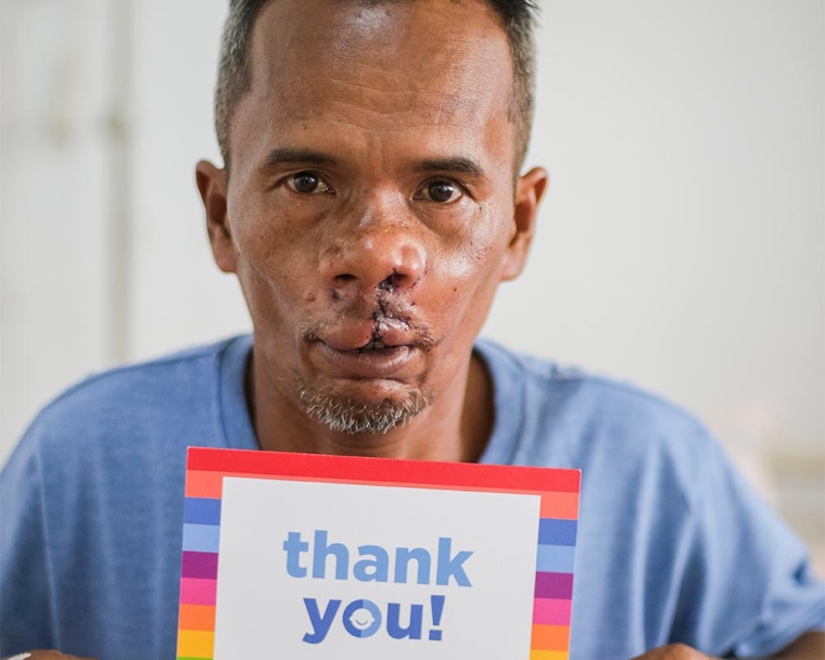 Alim holding a thank you sign after cleft surgery