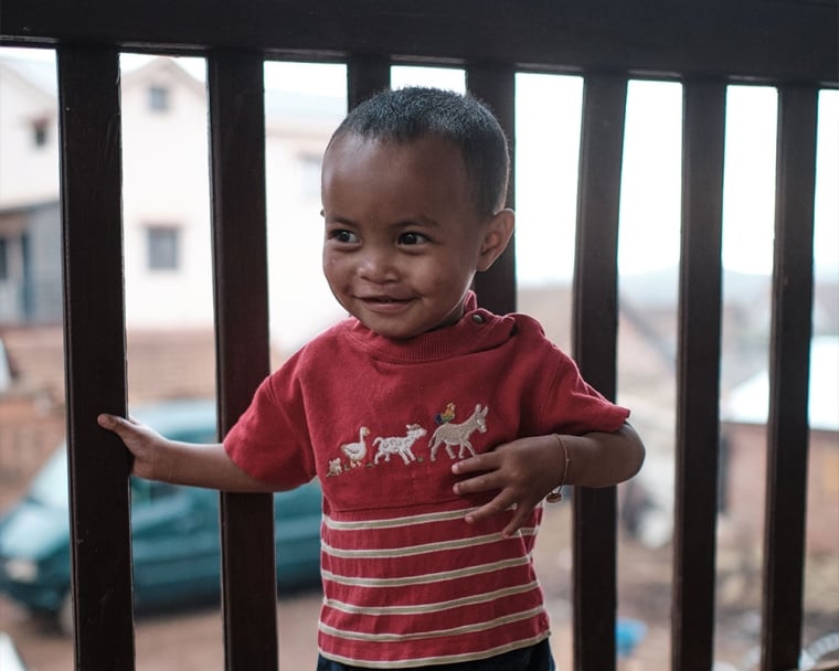 Eden after cleft surgery