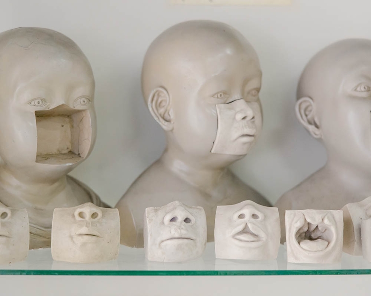 Thailand orthodontics