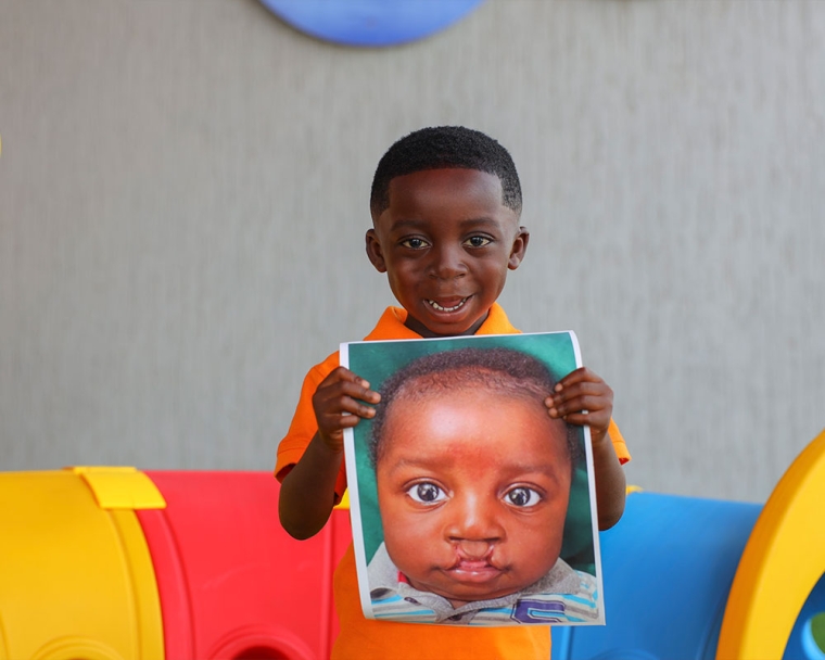 A smiling KATH patient holding a picture of himself before cleft surgery
