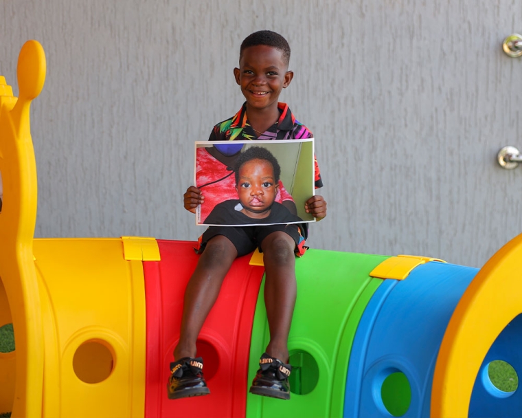 A smiling KATH patient holding a picture of himself before cleft surgery