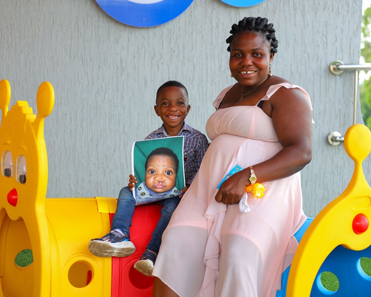 A KATH patient sitting beside his mother, holding a picture of himself before cleft surgery