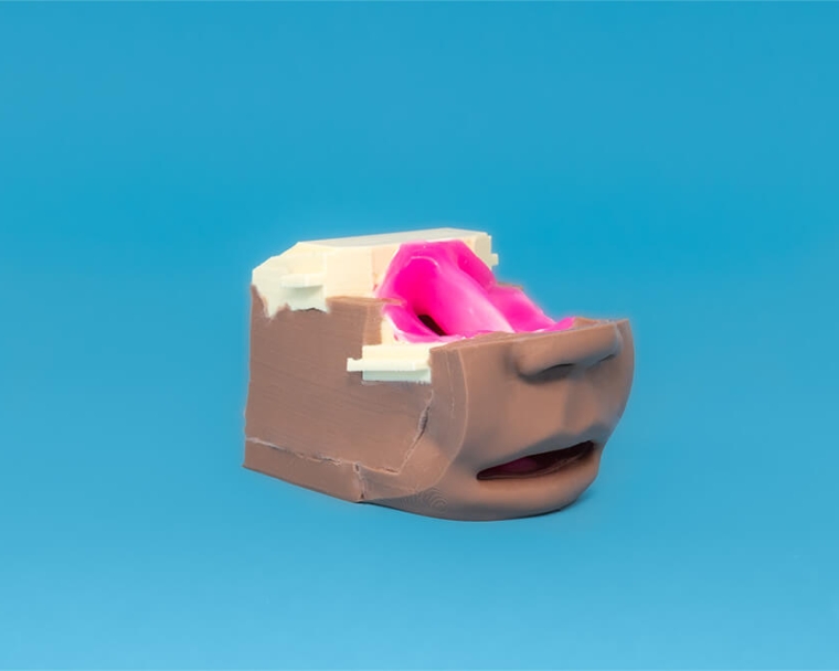 Angle of cleft cartridge