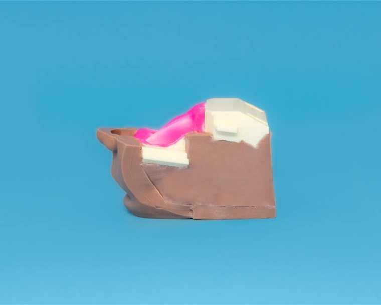 Side of cleft cartridge