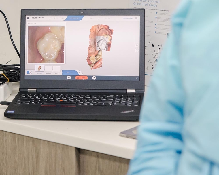 close-up of dental technology on laptop